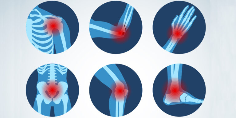 ការរលាកសរីរាង្គ