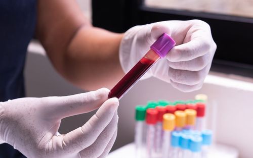 ជំងឺស្លេកស្លាំង