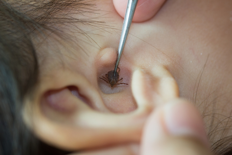 សត្វល្អិតចូលត្រចៀក