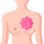 ជំងឺមហារីក